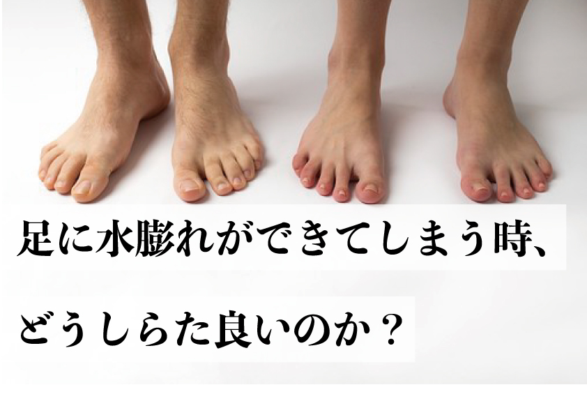 足に水膨れができてしまう時 どうしたら良いのか バッシュの選び方ブログ